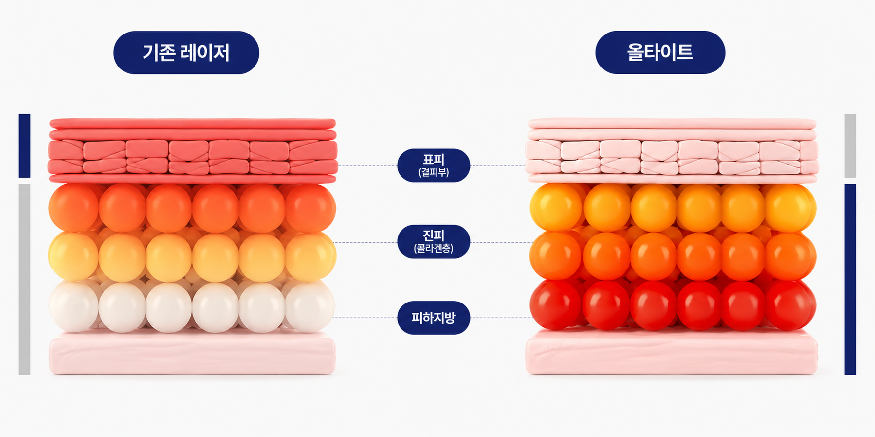 기존레이저 vs 올타이트 에너지 레이어 비교